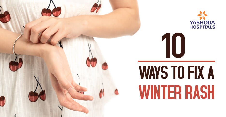 How to Fix a Winter Rash?